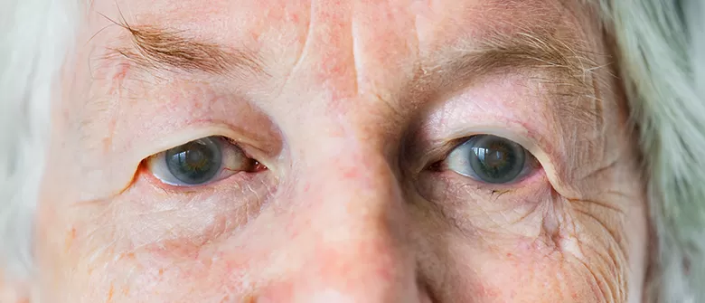 Cirurgia de Catarata